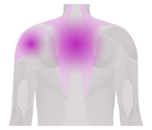 Idiopathic inflammatory myopathies