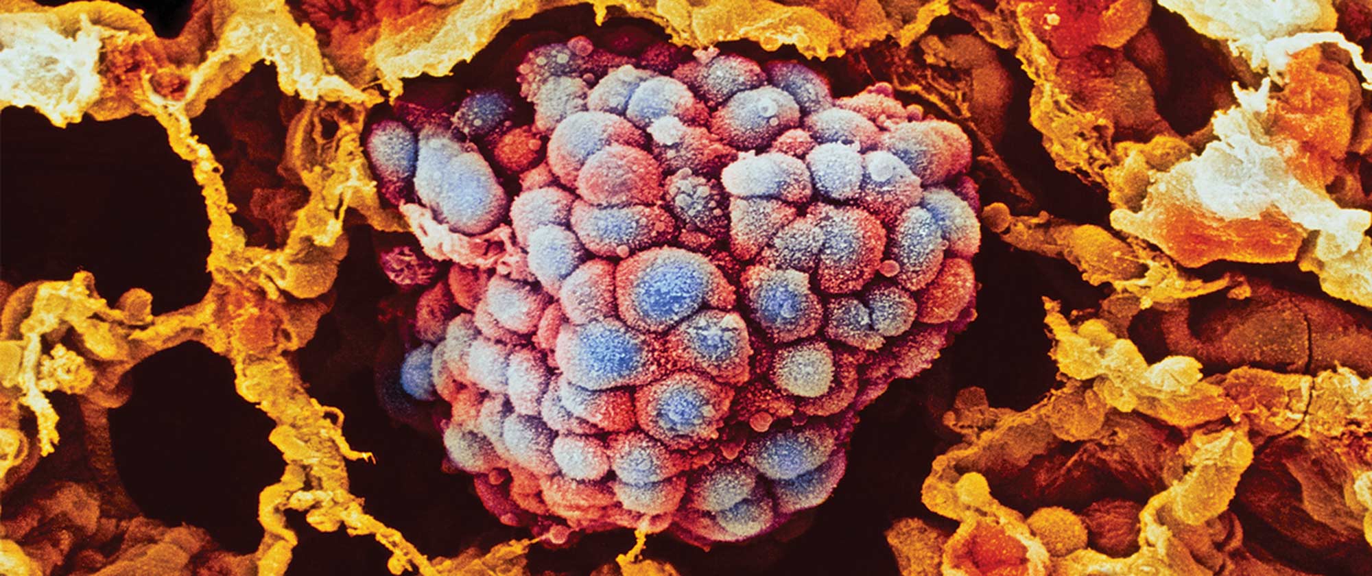 Researching lung cancer treatments to give more patients better outcomes