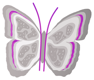 Systemic lupus erythematosus